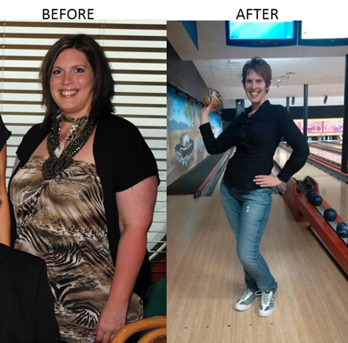 Duodenal Switch in Mexico Patient Results Published by